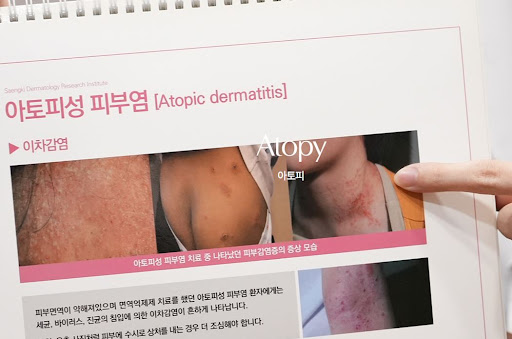 생기한의원 아토피 정보, 얼굴과 목 부위 증상 확인 사항